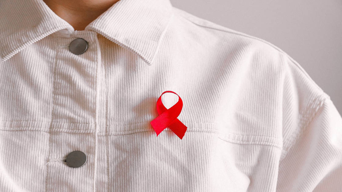 Penyebab gejala kulit HIV